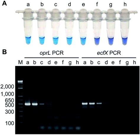 biochemical test of pseudomonas aeruginosa|Detection methods for Pseudomonas aeruginosa : history and future pe.